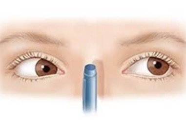 Eye focusing exercise showing the best convergence insufficiency treatment in Sector 51, Gurugram.