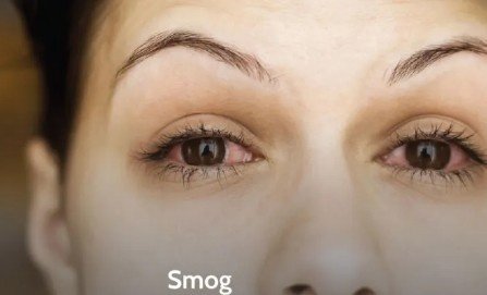 Best Eye Care in Air Pollution in Sector 51, Gurugram