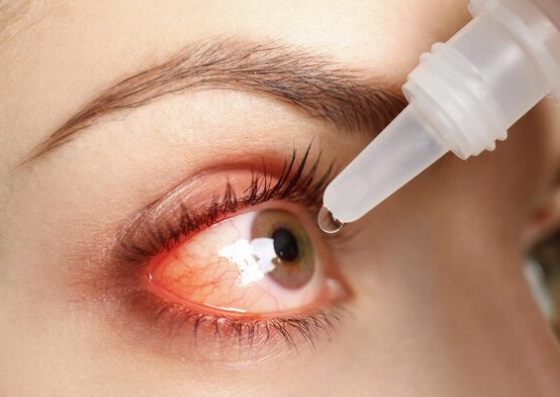 Eye Burning Sensation Treatment in Sector 50, Gurugram