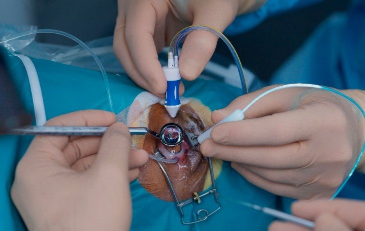 Retinal Detachment Surgery in Sector 51, Gurugram