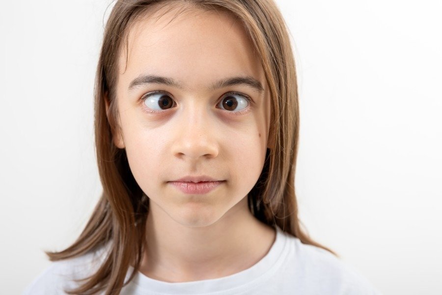 Best Squint Eye Treatment in Gurgaon